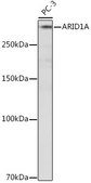 Anti-ARID1A Antibody, clone 9D4J6, Rabbit Monoclonal