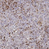 Anti-MYO1F antibody produced in rabbit Prestige Antibodies&#174; Powered by Atlas Antibodies, affinity isolated antibody, buffered aqueous glycerol solution