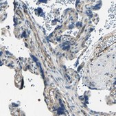 Anti-RAPGEF1 antibody produced in rabbit Prestige Antibodies&#174; Powered by Atlas Antibodies, affinity isolated antibody, buffered aqueous glycerol solution