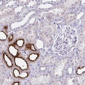 Anti-SLC12A3 antibody produced in rabbit Prestige Antibodies&#174; Powered by Atlas Antibodies, affinity isolated antibody, buffered aqueous glycerol solution