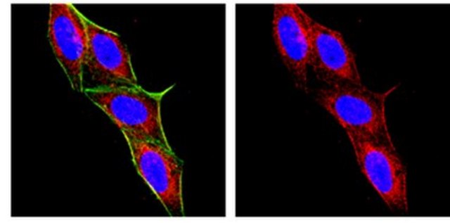 Anti-Macrophages/Granulocytes Antibody, clone OX-41 clone OX-41, Chemicon&#174;, from mouse