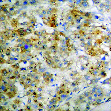 Anti-phospho-p70 S6 Kinase (pThr421) antibody produced in rabbit affinity isolated antibody