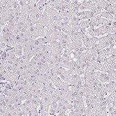 Anti-IL18BP antibody produced in rabbit Prestige Antibodies&#174; Powered by Atlas Antibodies, affinity isolated antibody, buffered aqueous glycerol solution