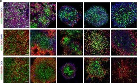Anti-Doublecortin Antibody serum, from guinea pig
