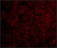 Anti-IRAK-M antibody produced in rabbit affinity isolated antibody, buffered aqueous solution