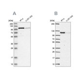 Anti-PRKD2 antibody produced in rabbit Prestige Antibodies&#174; Powered by Atlas Antibodies, affinity isolated antibody, buffered aqueous glycerol solution