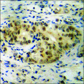 Anti-phospho-TNNI3 (pSer22+Ser23) antibody produced in rabbit affinity isolated antibody