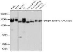 Anti-Integrin alpha V (ITGAV/CD51) Antibody, clone 10T9N2, Rabbit Monoclonal