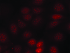 Anti-phospho-RPS6KB1 (pThr421) antibody produced in rabbit affinity isolated antibody