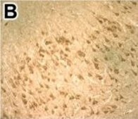 Anti-DNMT3B antibody produced in rabbit Prestige Antibodies&#174; Powered by Atlas Antibodies, affinity isolated antibody, buffered aqueous glycerol solution