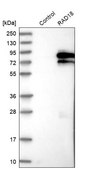 Anti-RAD18 antibody produced in rabbit Prestige Antibodies&#174; Powered by Atlas Antibodies, affinity isolated antibody, buffered aqueous glycerol solution