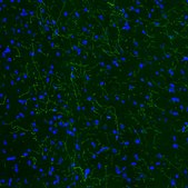 Monoclonal Anti-TPH2 antibody produced in mouse Prestige Antibodies&#174; Powered by Atlas Antibodies, clone CL2990, purified immunoglobulin, buffered aqueous glycerol solution