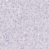 Anti-CTSE antibody produced in rabbit Prestige Antibodies&#174; Powered by Atlas Antibodies, affinity isolated antibody, buffered aqueous glycerol solution