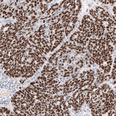 Anti-WT1 antibody produced in mouse Prestige Antibodies&#174; Powered by Atlas Antibodies, clone CL13176, purified by using Protein A, buffered aqueous glycerol solution