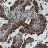 Monoclonal Anti-MCL1 antibody produced in mouse Prestige Antibodies® Powered by Atlas Antibodies, clone CL1128, purified immunoglobulin, buffered aqueous glycerol solution