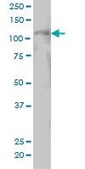 ANTI-PTK2 antibody produced in mouse clone 1D7, purified immunoglobulin, buffered aqueous solution