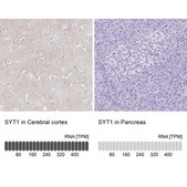 Anti-SYT1 antibody produced in rabbit Prestige Antibodies&#174; Powered by Atlas Antibodies, affinity isolated antibody, buffered aqueous glycerol solution
