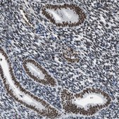 Anti-DDX5 antibody produced in rabbit Prestige Antibodies&#174; Powered by Atlas Antibodies, affinity isolated antibody, buffered aqueous glycerol solution