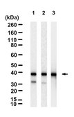 Anti-SCD Antibody, clone 2C2 ZooMAb&#174; Rabbit Monoclonal recombinant, expressed in HEK 293 cells