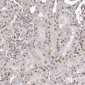 Anti-WRAP53 antibody produced in rabbit Prestige Antibodies&#174; Powered by Atlas Antibodies, affinity isolated antibody, buffered aqueous glycerol solution