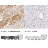 Anti-MYBPC1 antibody produced in rabbit Prestige Antibodies&#174; Powered by Atlas Antibodies, affinity isolated antibody, buffered aqueous glycerol solution