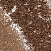 Anti-CAMK2B antibody produced in rabbit Prestige Antibodies&#174; Powered by Atlas Antibodies, affinity isolated antibody, buffered aqueous glycerol solution