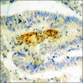 Anti-phospho-IRF-3 (pSer396) antibody produced in rabbit affinity isolated antibody