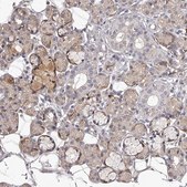 Anti-TNN antibody produced in rabbit Prestige Antibodies&#174; Powered by Atlas Antibodies, affinity isolated antibody, buffered aqueous glycerol solution, ab2