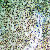 Anti-phospho-PP2A-&#945; (pTyr307) antibody produced in rabbit affinity isolated antibody