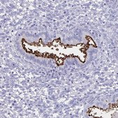 Anti-SLC34A2 antibody produced in rabbit Prestige Antibodies&#174; Powered by Atlas Antibodies, affinity isolated antibody, buffered aqueous glycerol solution