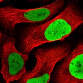Anti-MCM4 antibody produced in rabbit Prestige Antibodies&#174; Powered by Atlas Antibodies, affinity isolated antibody