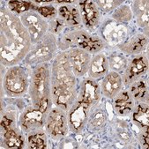 Anti-RWDD2A antibody produced in rabbit Prestige Antibodies® Powered by Atlas Antibodies, affinity isolated antibody, buffered aqueous glycerol solution, ab3