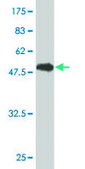 Monoclonal Anti-GSTT1 antibody produced in mouse clone 2E10-1B2, purified immunoglobulin, buffered aqueous solution