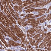 Anti-CKM antibody produced in rabbit Prestige Antibodies&#174; Powered by Atlas Antibodies, affinity isolated antibody, buffered aqueous glycerol solution