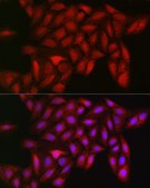 Anti-LDHA antibody produced in rabbit