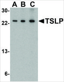 Anti-TSLP (ab2) antibody produced in rabbit affinity isolated antibody, buffered aqueous solution