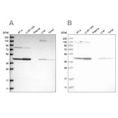 Anti-CNP antibody produced in rabbit Prestige Antibodies&#174; Powered by Atlas Antibodies, affinity isolated antibody, buffered aqueous glycerol solution, Ab4