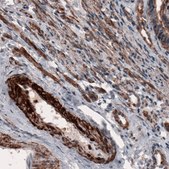 Monoclonal Anti-ACTB antibody produced in mouse Prestige Antibodies&#174; Powered by Atlas Antibodies, clone CL3868, purified immunoglobulin, buffered aqueous glycerol solution