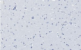 Anti-MCAM/CD146 Antibody, clone 1C21 ZooMAb&#174; Rabbit Monoclonal recombinant, expressed in HEK 293 cells
