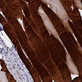 Anti-TNNT3 antibody produced in rabbit Prestige Antibodies&#174; Powered by Atlas Antibodies, affinity isolated antibody, buffered aqueous glycerol solution