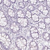 Anti-HBQ1 antibody produced in rabbit Prestige Antibodies&#174; Powered by Atlas Antibodies, affinity isolated antibody, buffered aqueous glycerol solution