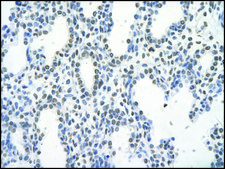 Anti-FOSL1 affinity isolated antibody