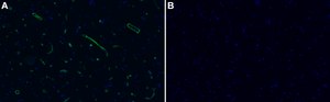 Anti-Laminin &#945;2 80 kDa Antibody, clone 5H2 ZooMAb&#174; Mouse Monoclonal recombinant, expressed in HEK 293 cells