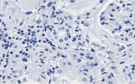 Anti-PARP-1 Antibody, clone 12N17 Antibody, ZooMAb® Rabbit Monoclonal recombinant, expressed in HEK 293 cells
