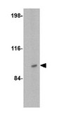 Anti-SATB2 Antibody from rabbit, purified by affinity chromatography