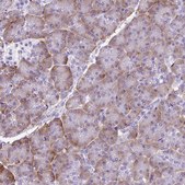 Anti-PDIA2 antibody produced in rabbit Prestige Antibodies&#174; Powered by Atlas Antibodies, affinity isolated antibody, buffered aqueous glycerol solution