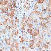 Anti-ACVR1B antibody produced in rabbit