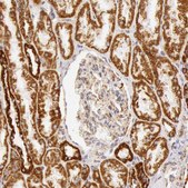 Anti-ATP5B antibody produced in rabbit Ab1, Prestige Antibodies&#174; Powered by Atlas Antibodies, affinity isolated antibody, buffered aqueous glycerol solution