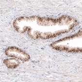 Monoclonal Anti-GRN antibody produced in mouse Prestige Antibodies&#174; Powered by Atlas Antibodies, clone CL5695, purified immunoglobulin, buffered aqueous glycerol solution