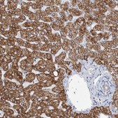 Anti-BDH1 antibody produced in rabbit Prestige Antibodies&#174; Powered by Atlas Antibodies, affinity isolated antibody, buffered aqueous glycerol solution